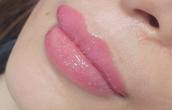 lips embroidery pigmentation variation in singapore 1