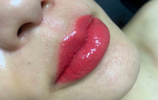 lips embroidery pigmentation variation in singapore 2