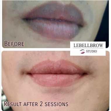 lips tattoo results in singapore